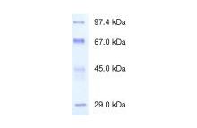 Protein Test Mixture 4 for SDS PAGE 4 Dalton-marker proteins, high molecular weight, for SDS PAGE
