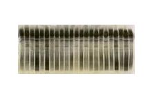 SERVALYT(TM) PRECOTES(TM) CSF Kit (for IEF of Cerebrospinal Fluid)