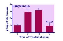 EnzyFluo Human/Mouse RB(T821/826) Phosphorylation ELISA Kit