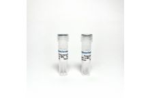 Phospho-Tau Thr217 (p-tau217) Polyclonal Antibody Validated as Capture in ELISA