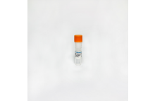 RBM20 Rabbit Polyclonal Antibody