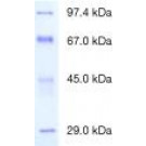 Protein Test Mixture 4 for SDS PAGE 4 Dalton-marker proteins, high molecular weight, for SDS PAGE