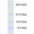 Protein Test Mixture 5 for SDS PAGE Dalton-marker proteins, low molecular weight, for SDS PAGE
